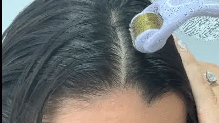 Derma Roller | Titanium Alloy Needles For Hair Growth